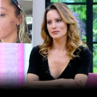 "Kocam tarafından darp edildim"