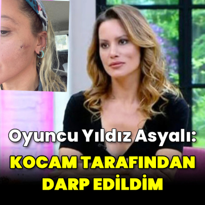 "Kocam tarafından darp edildim"