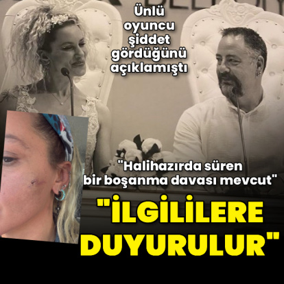 Darp iddialarına yanıt