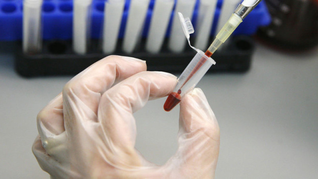 Danıştay'dan AIDS tazminatı kararı