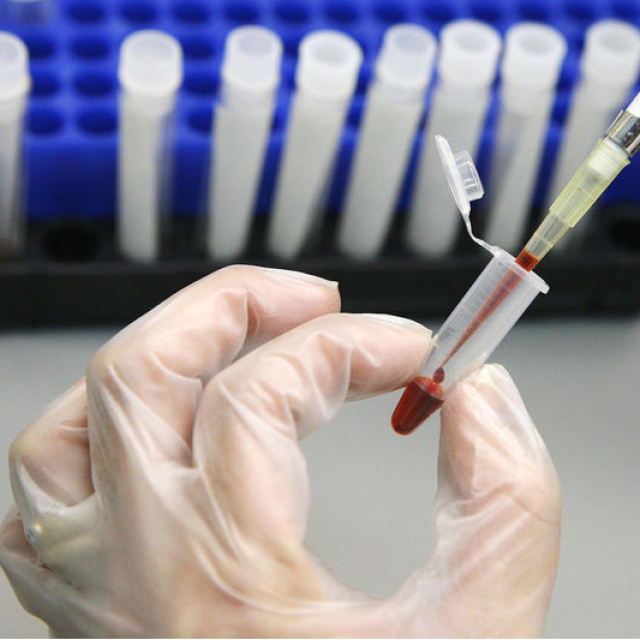 Danıştay'dan AIDS tazminatı kararı