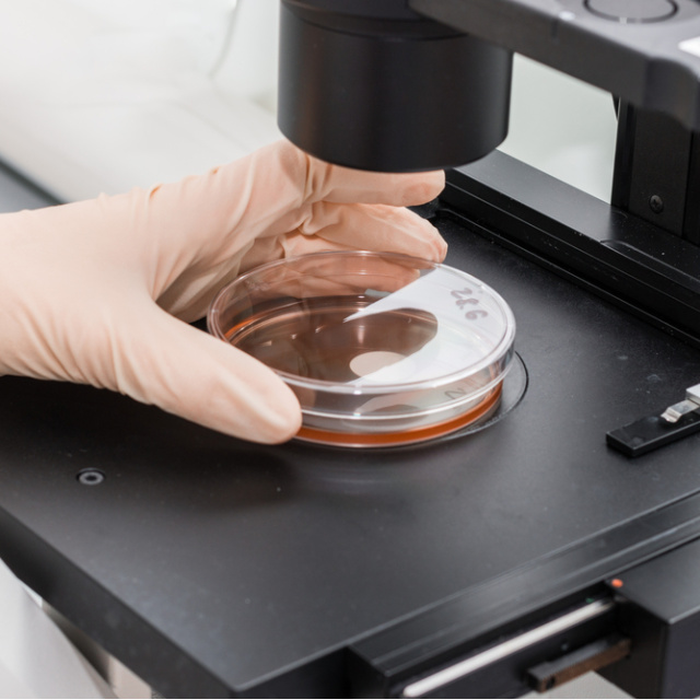 Ağır yanıkların iz bırakmaması için kök hücre üzerine çalışma yapılıyor