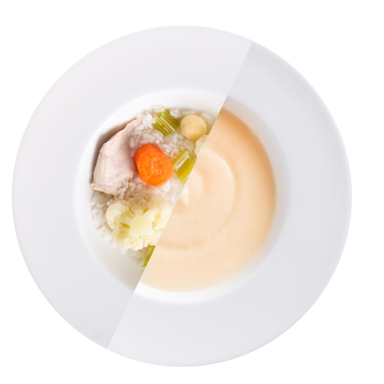 Apandisit ameliyatı sonrası ne yenir?