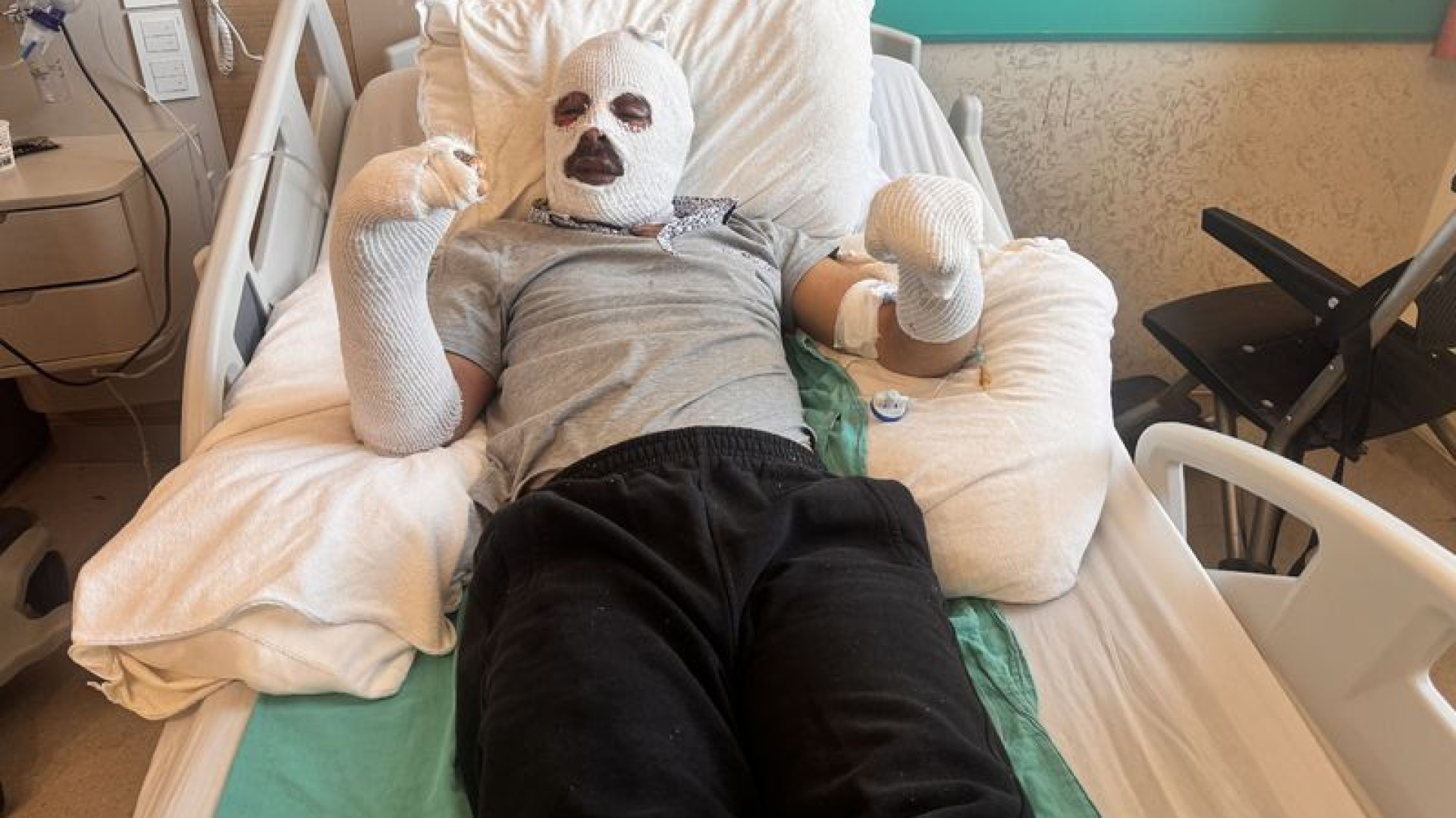 Son dakika: İşitme engelli genç çay demlerken evi havaya uçurdu: Vücudunun büyük kısmı yandı | Son dakika haberleri