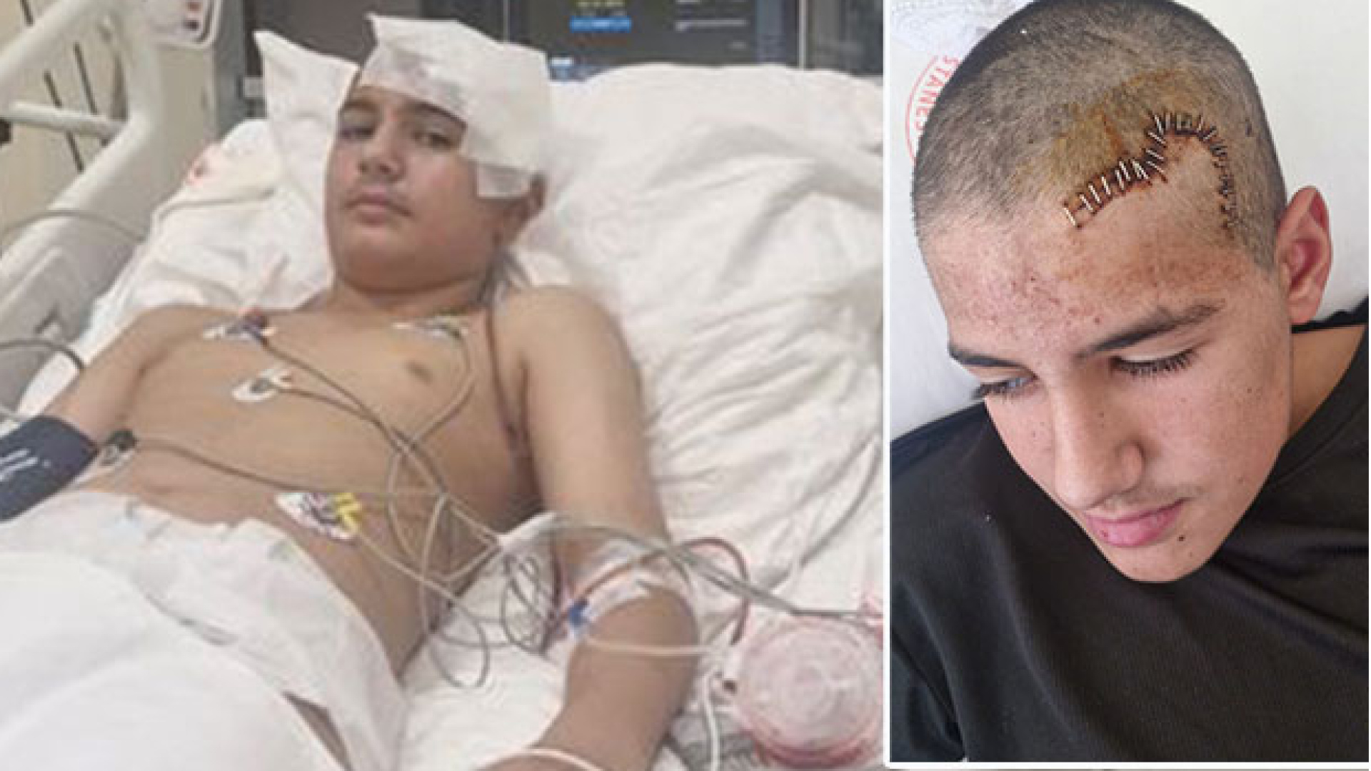 Konya haberleri: Şakalaştığı arkadaşı taşla kafatasını kırdı | SON DAKİKA HABER | Son dakika haberleri