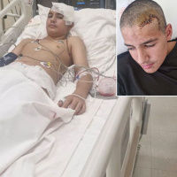 Şakalaştığı arkadaşı taşla kafatasını kırdı!