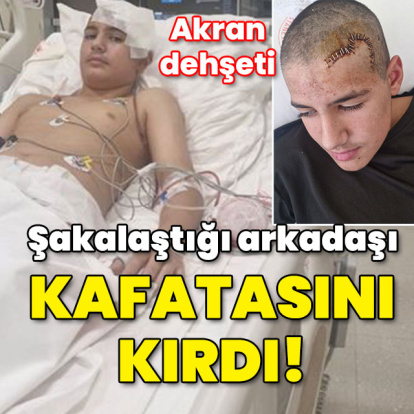Şakalaştığı arkadaşı taşla kafatasını kırdı!