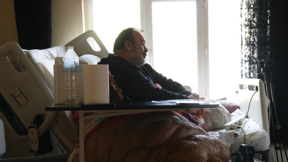 5 yıldır evden çıkmıyor! Fil hastasının hayali eşiyle kol kola caddede gezmek