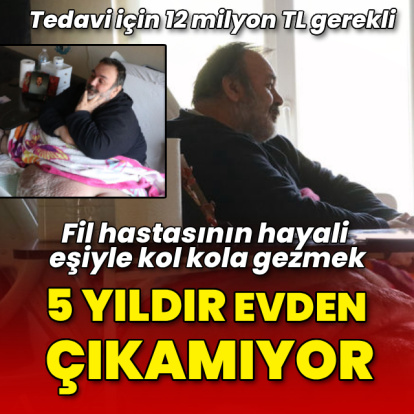5 yıldır evden çıkmıyor! Fil hastasının hayali eşiyle kol kola caddede gezmek