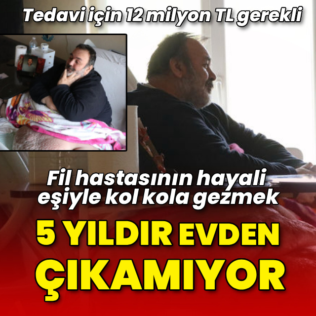 5 yıldır evden çıkmıyor! Fil hastasının hayali eşiyle kol kola caddede gezmek