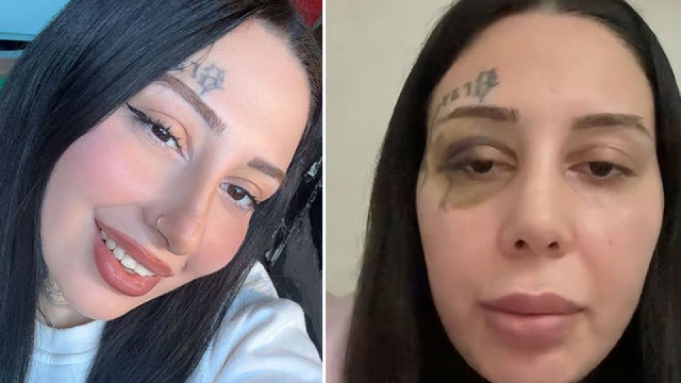 Cinsel istismar, tehdit ve şiddet... Dramdan burun estetiği çıktı!