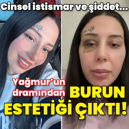 Cinsel istismar, tehdit ve şiddet... Dramdan burun estetiği çıktı!