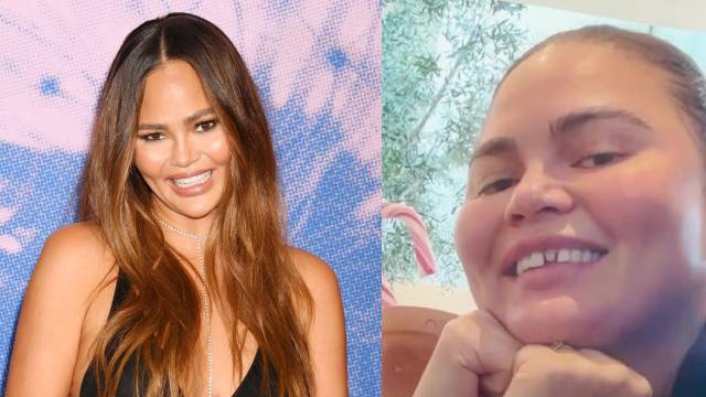 Kırık dişli halini gösterdi