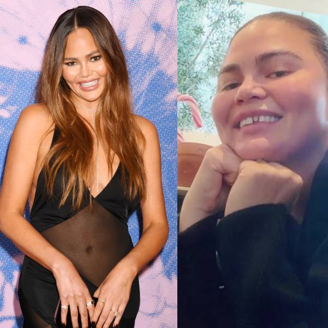 Kırıklı dişli halini gösterdi