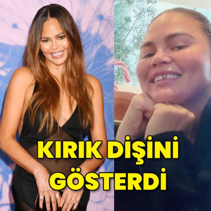 Kırık dişli halini gösterdi