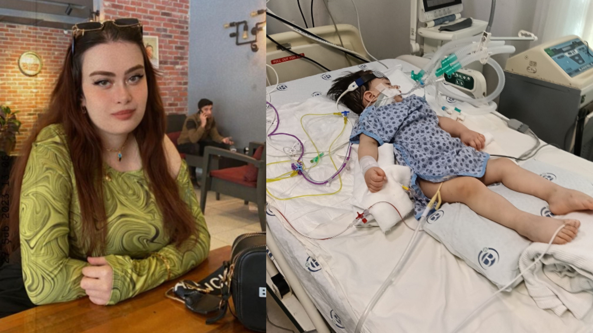 Anestezi sonrası dram! Biri öldü diğeri yatalak | Sağlık Haberleri