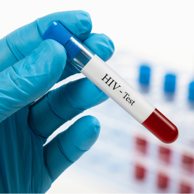 Türkiye'de HIV vakaları artıyor