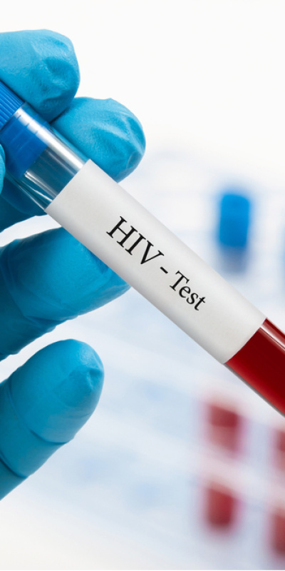 Türkiye'de HIV vakaları artıyor