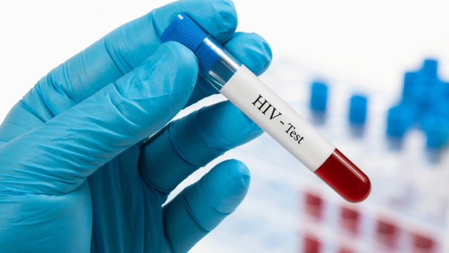 Türkiye'de HIV vakaları artıyor