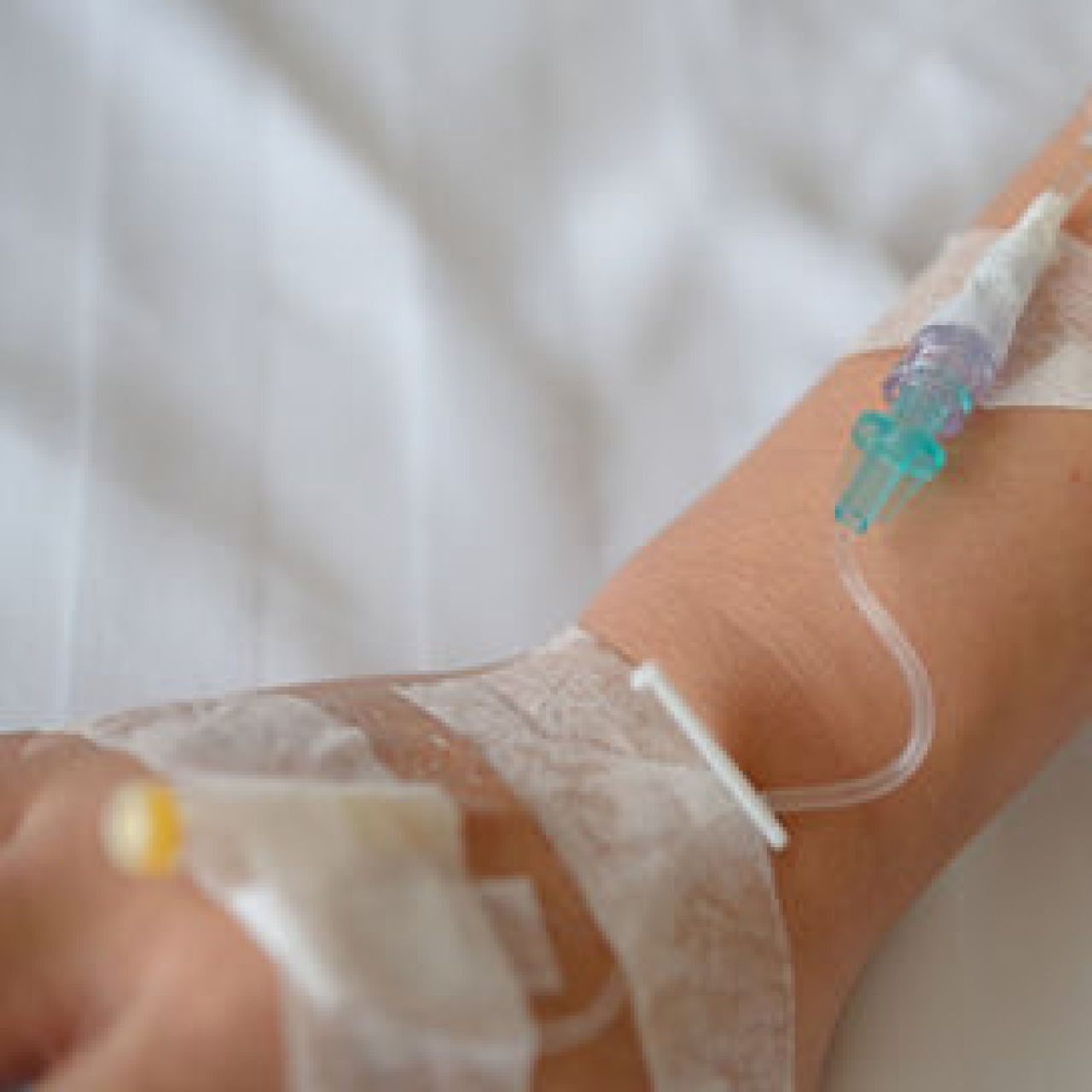 Parenteral beslenme nedir?