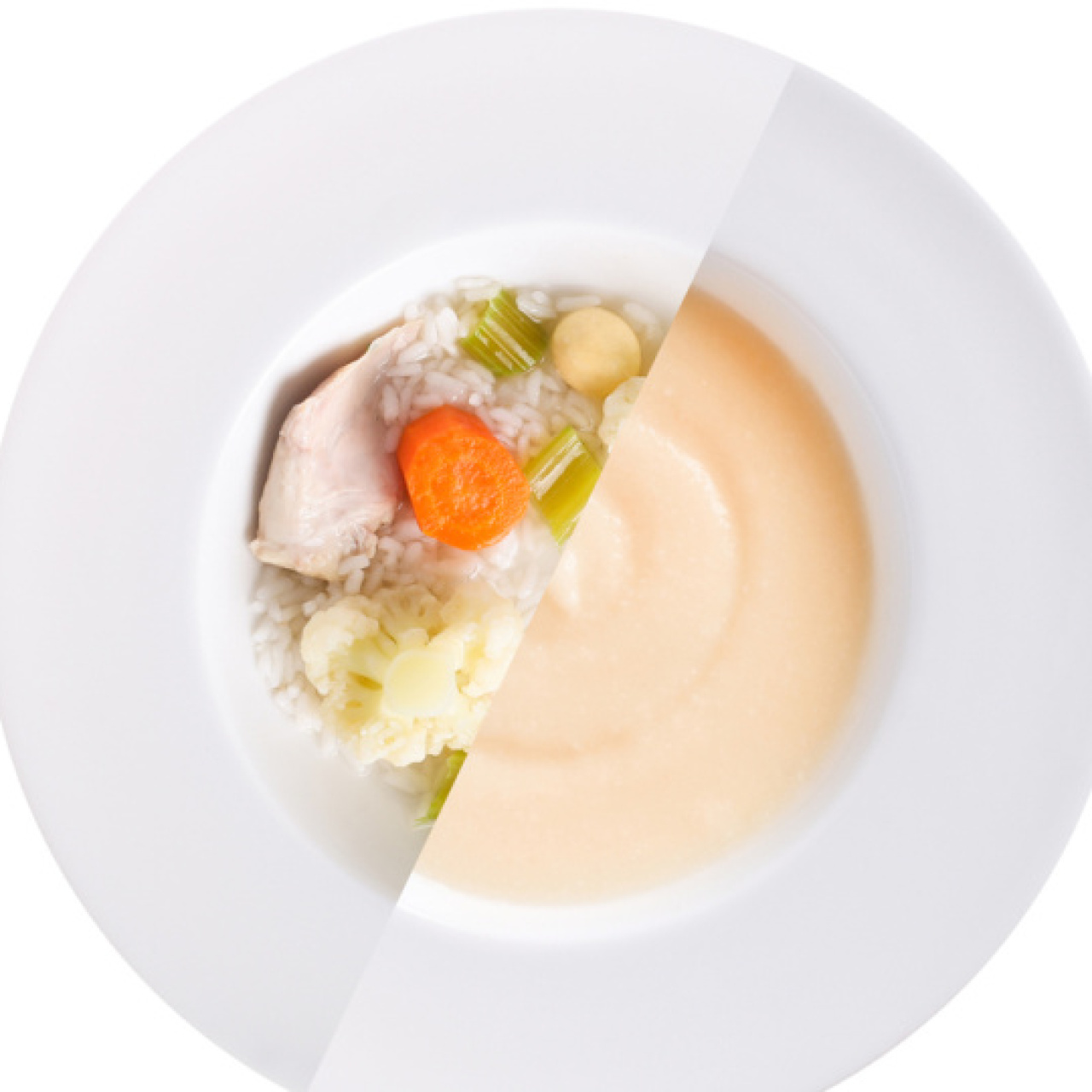 Safra kesesi ameliyat sonrası ne yenir