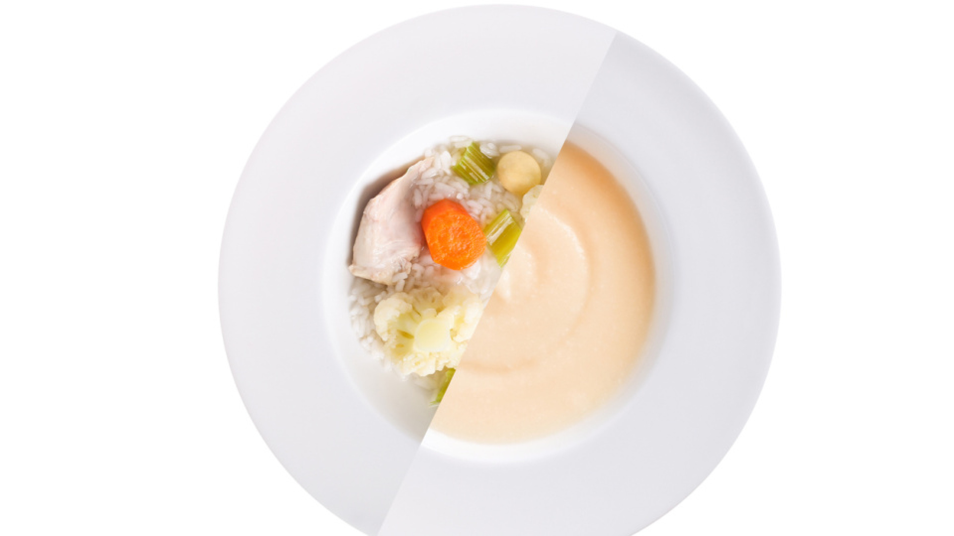 Safra kesesi ameliyatı sonrası ne yenir, nasıl beslenilir? htsg