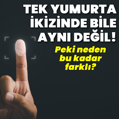 Tek yumurta ikizlerininki bile aynı değil!