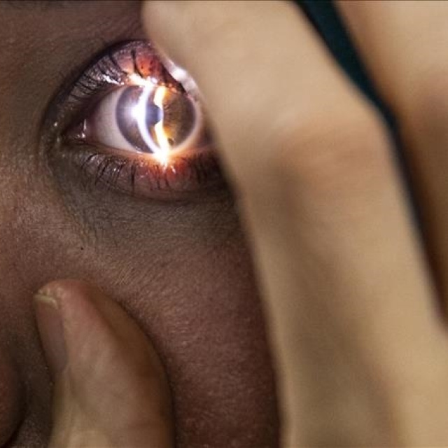 Yapay zeka ihmal edilen göz sağlığı tedavisini zorlaştırıyor