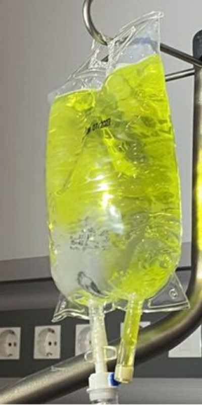 Uzmanlardan ‘sarı serum’ uyarısı!