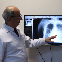 Elektronik sigaranın akciğerde yol açtığı hasar yoğun bakımla sonuçlanıyor