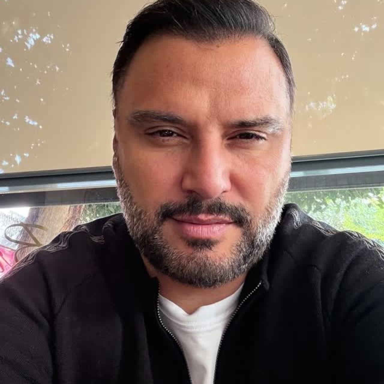 Botoks iddialarına yanıt