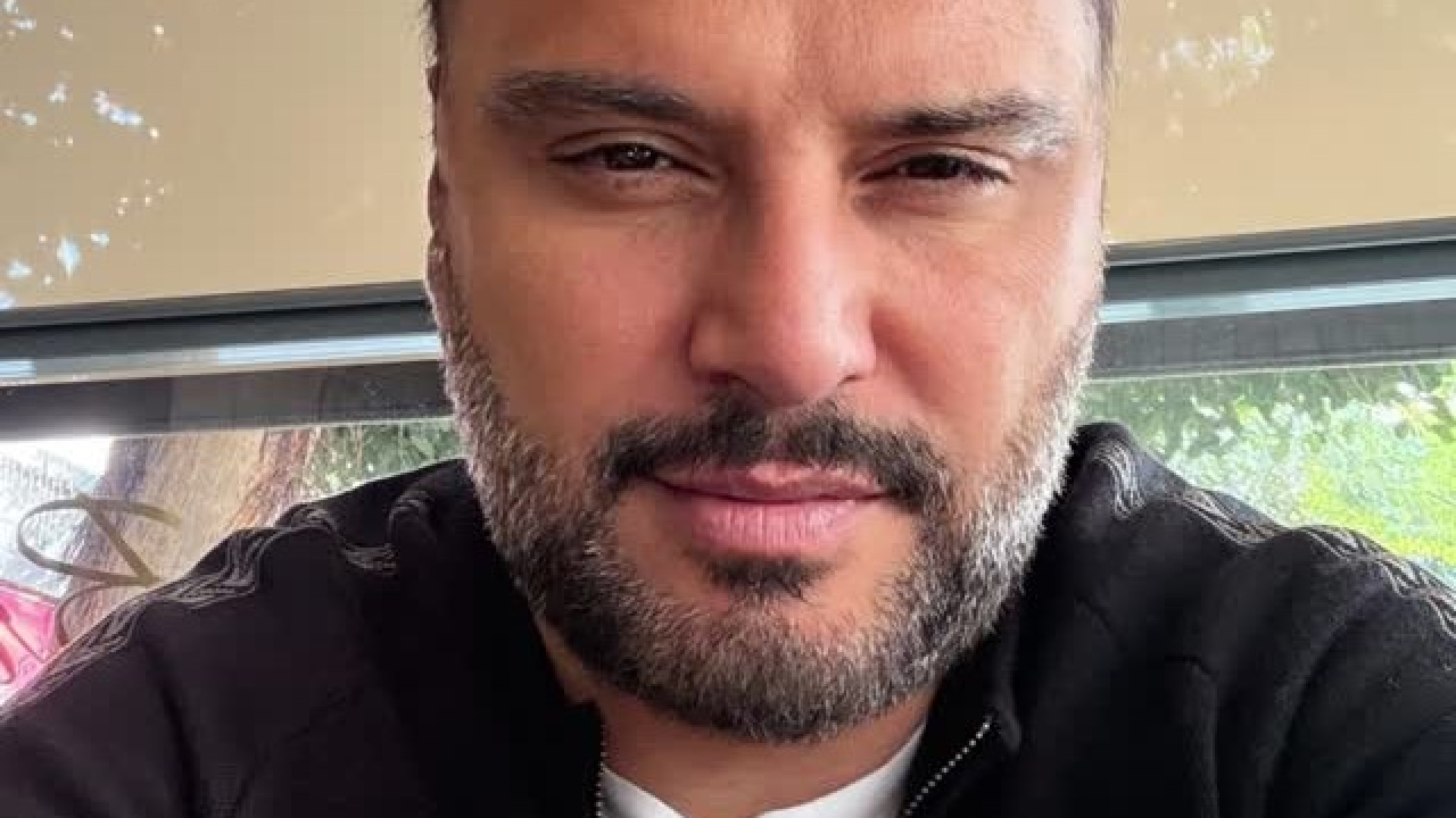 Alişan'dan botoks iddialarına yanıt: Kaşlar düştü