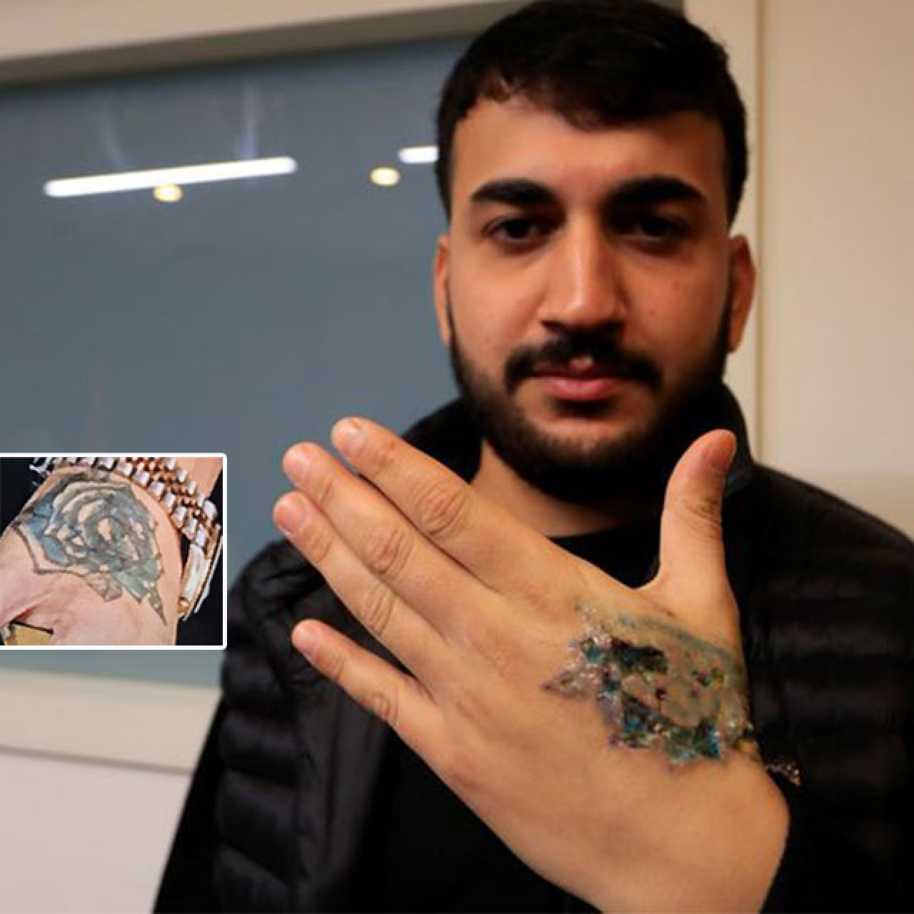 Dövmesini sildirecekti kâbusu yaşadı!