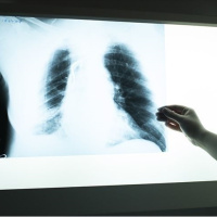 3 haftayı aşan öksürük ve kilo kaybına dikkat!