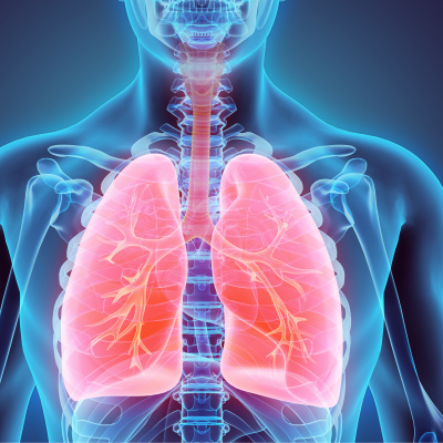 O tedavi tüberküloz vakalarını artırıyor