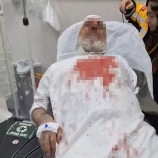 Yaşlı adamı öldüresiye darbettiler!