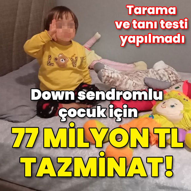 Down sendromlu çocuk için 77 milyon TL tazminat!