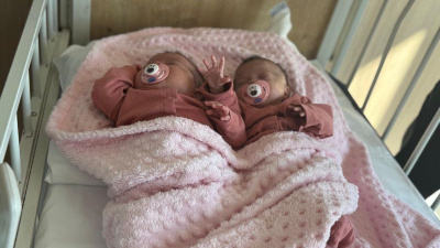 Prematüre ikizler, anjiyoyla hayata tutundu