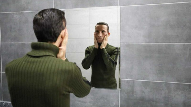 Türkiye'nin ilk yüz naklinin 14. yılı kutlandı