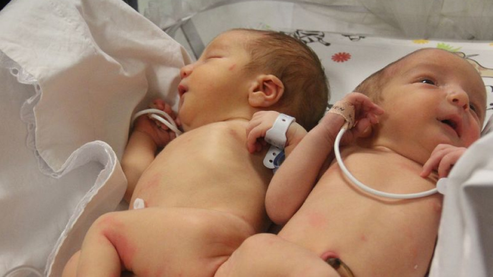 Siyam ikizlerini 9 yaşında ölüm ayırdı