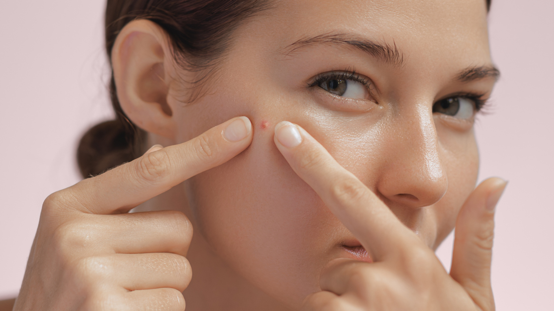 Diyanet Açıkladı: Oruçluyken Sivilce Sıkmak Orucu Bozar mı?