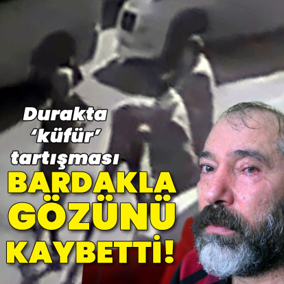 Bardakla darp edildi! Gözünü kaybetti