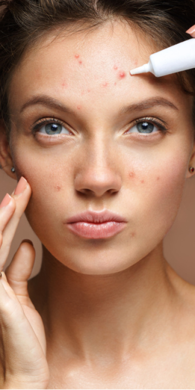 Sivilcelere karşı doğru beslenme önerileri