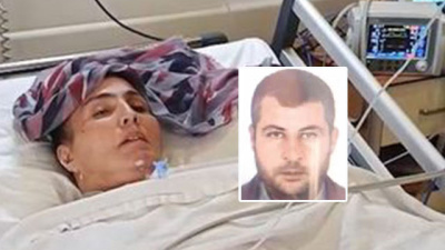 Kan donduran şiddet! 54 gün oldu... Makineyle yaşıyor!