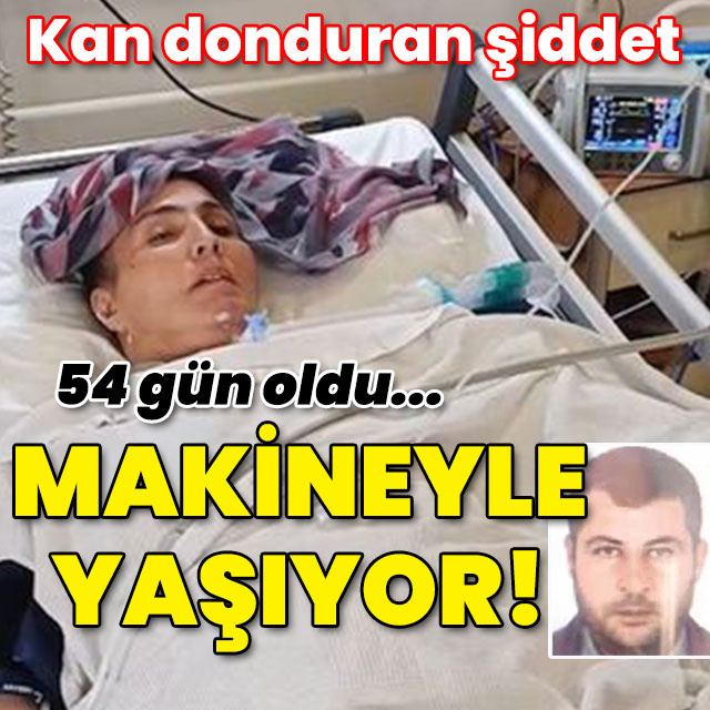 Kan donduran şiddet! 54 gün oldu... Makineyle yaşıyor!