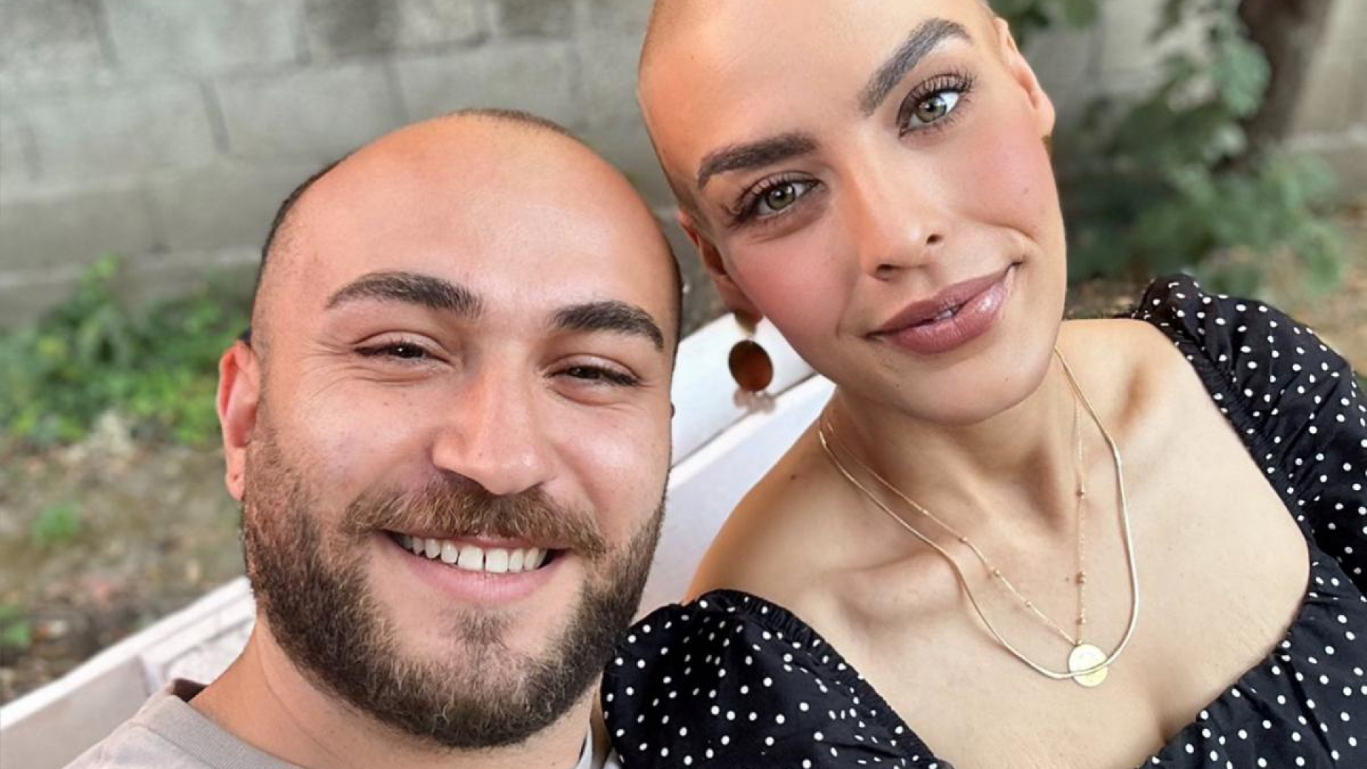 Saçını kazıtan eşinin desteğiyle meme kanserini yendi - Haberler | Sağlık Haberleri