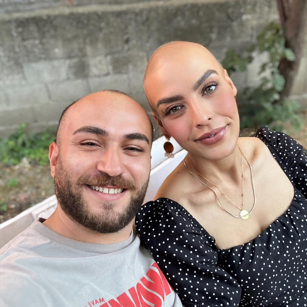 Saçını kazıtan eşinin desteğiyle meme kanserini yendi