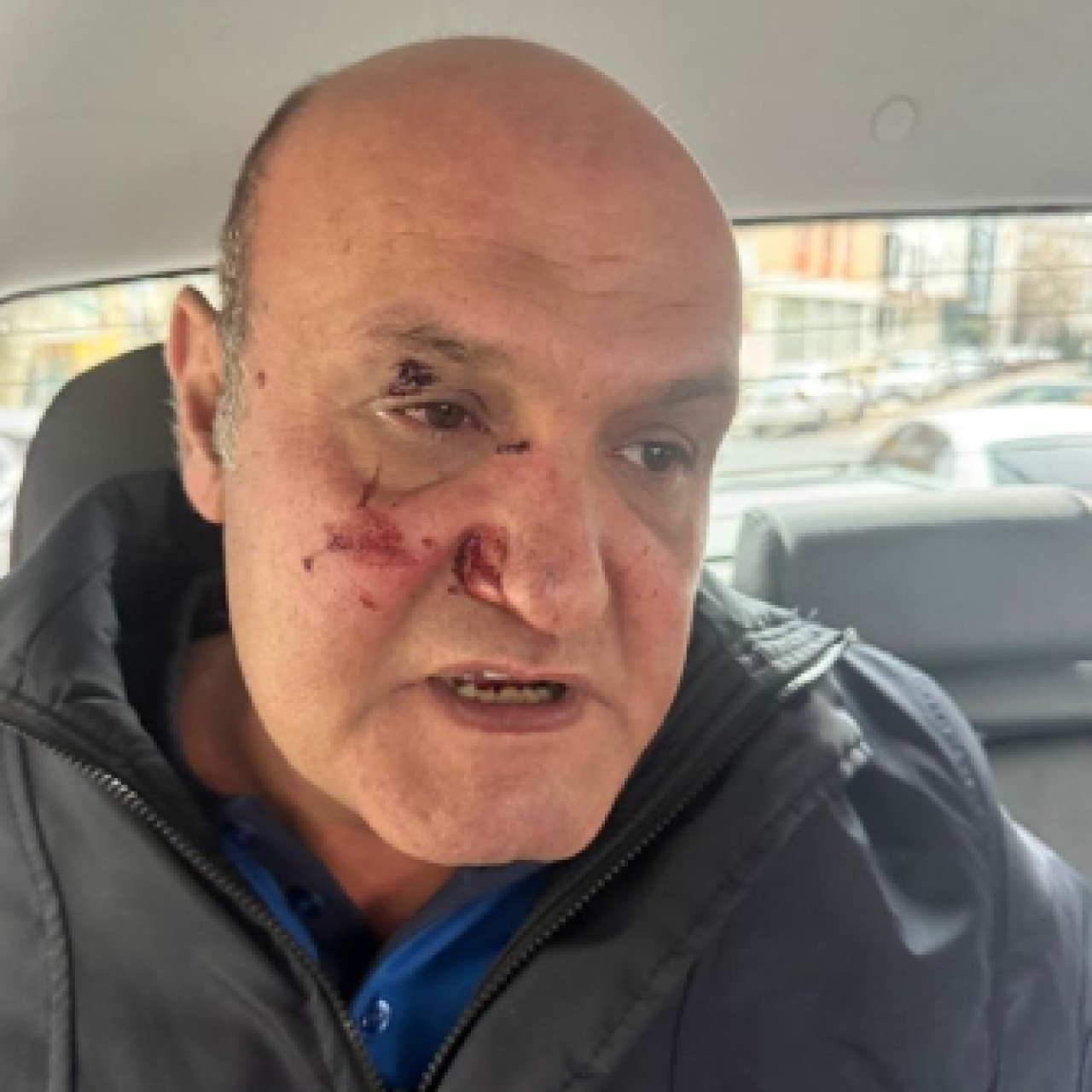 "Fotoğraf çekme" yumruğu