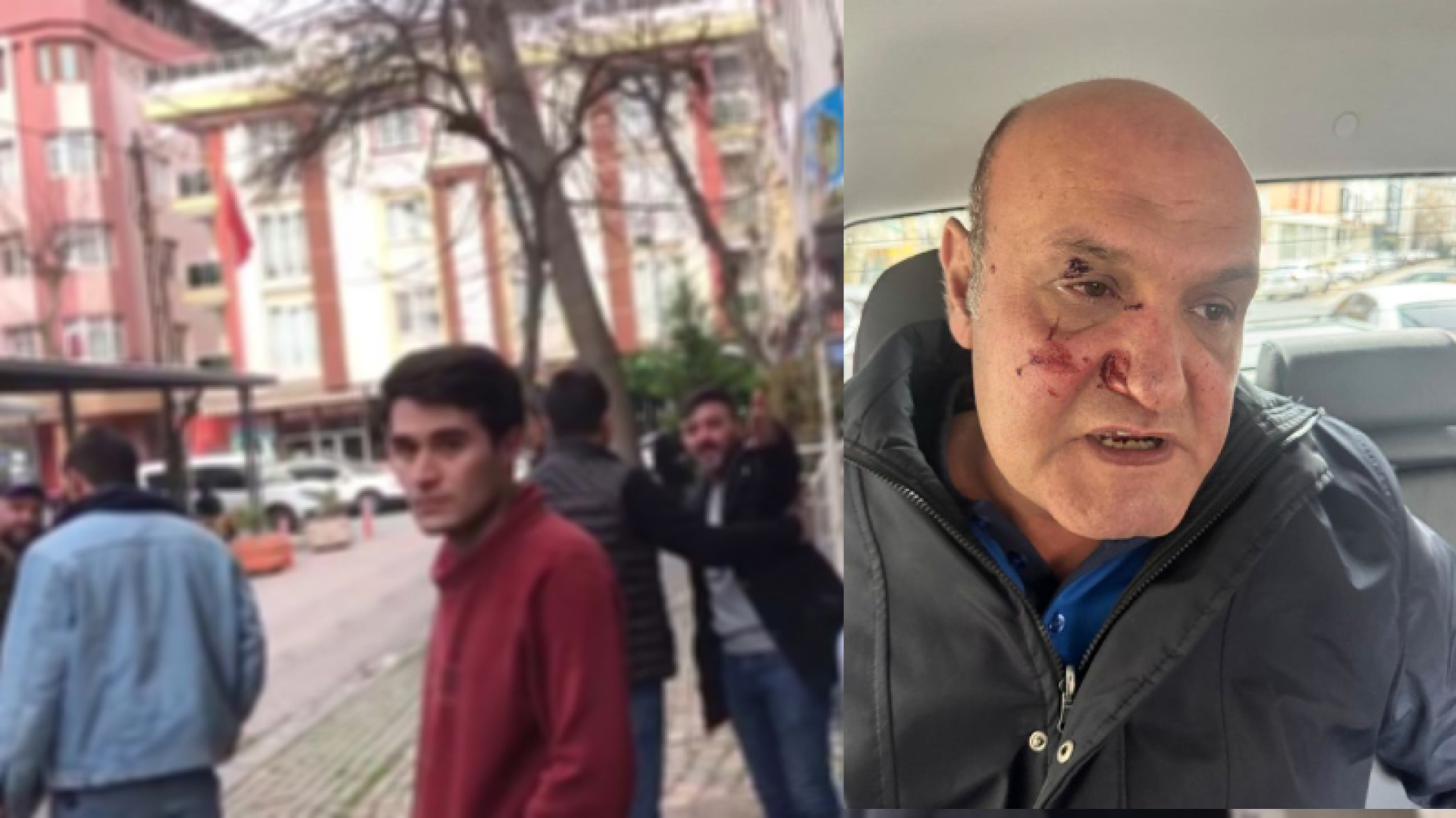 Avcılar'da Zabıta Memuruna Saldırı: Fotoğraf Çekmek İsterken Yumruklandı
