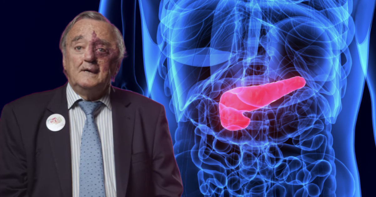 Pankreas kanserini tedavi eden araştırma umut oldu